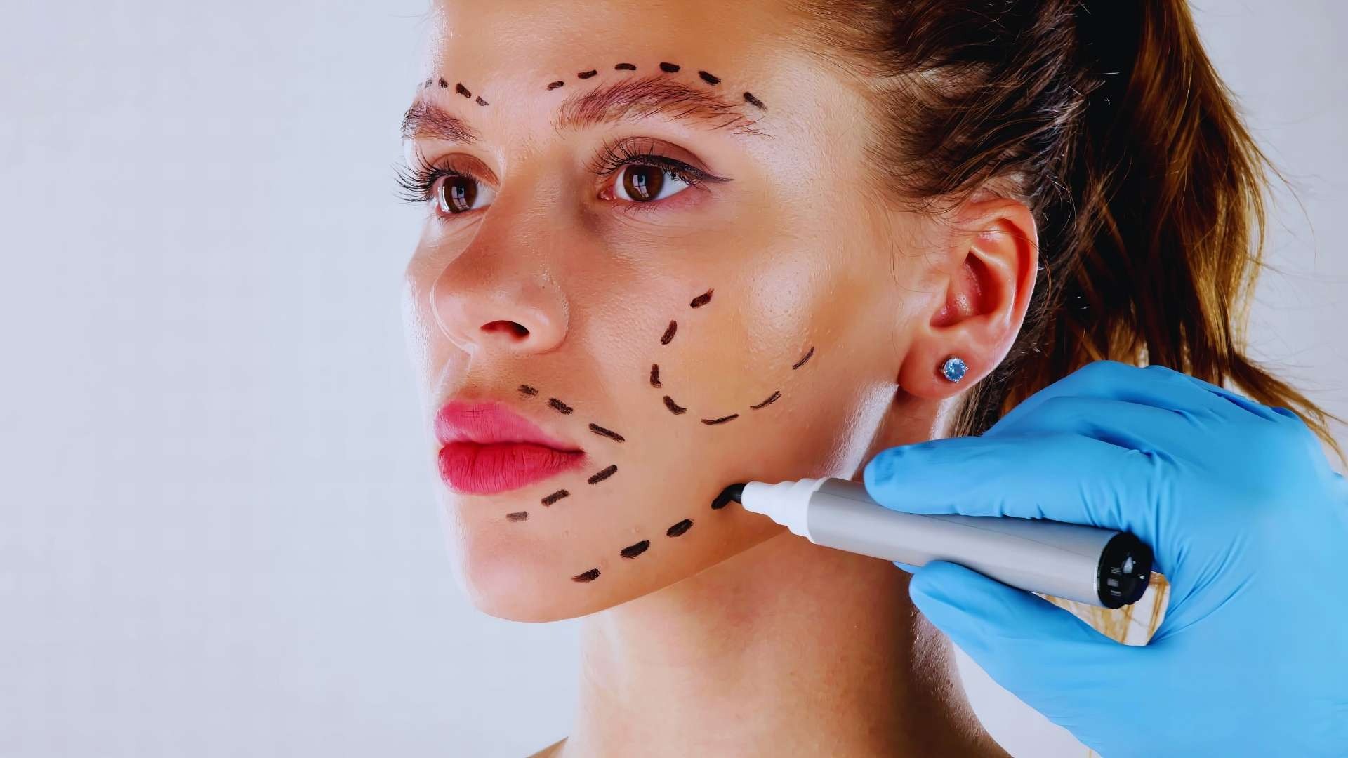 Por qué huimos de los protocolos estándar en medicina estética - Dermayud