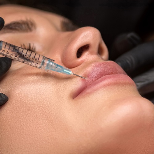 Relleno de labios